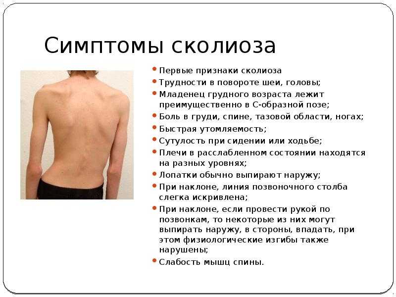Основные принципы гимнастики норбекова для сохранения здоровья спины. клиника бобыря