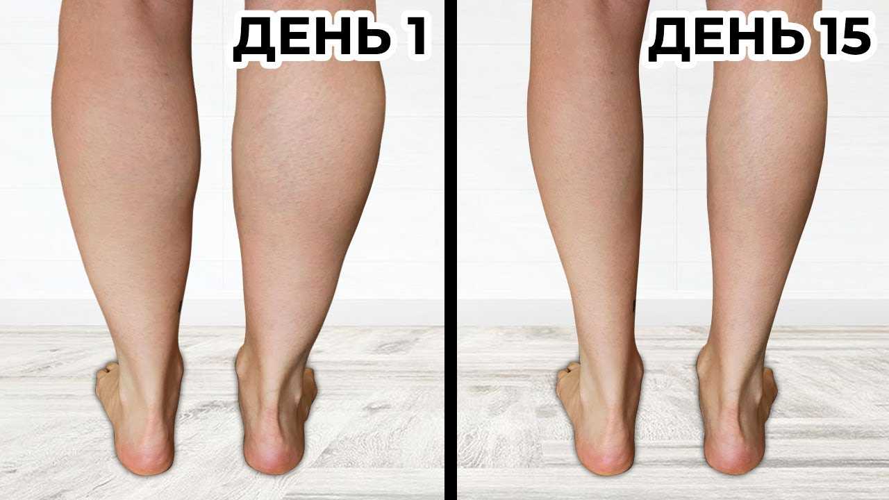 Как похудеть в икрах ног за короткий промежуток в домашних условиях
