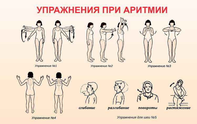 Упражнения при сердечно сосудистых заболеваниях с картинками