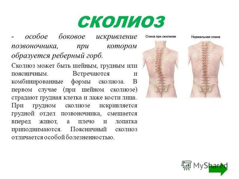 Упражнения при болях в спине и пояснице