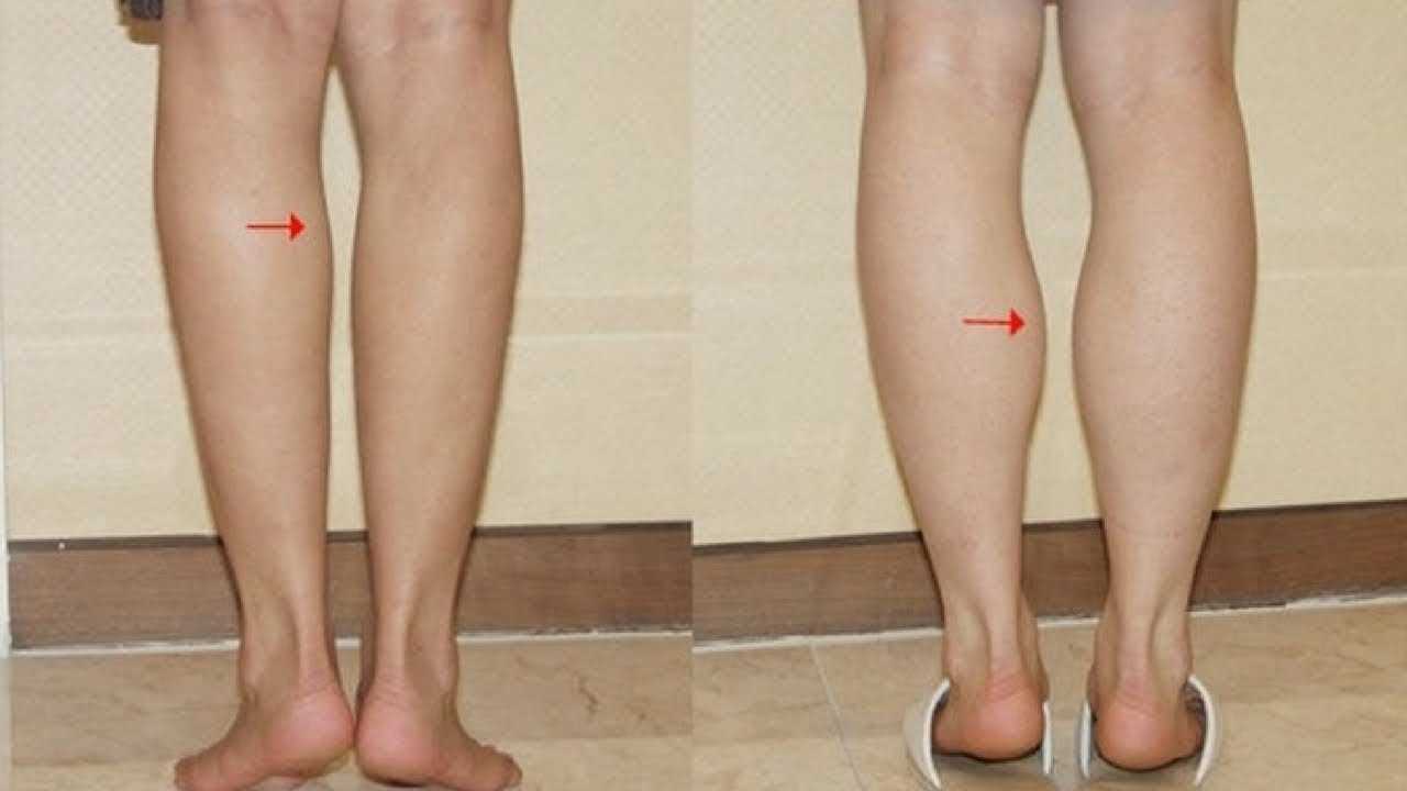 Тянет ноги: причины тянущей боли в мышцах, что делать – эл клиника