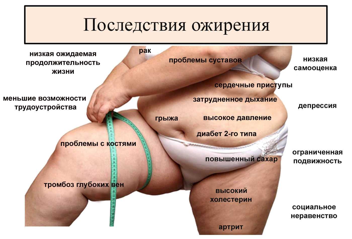 Последствия лишнего веса