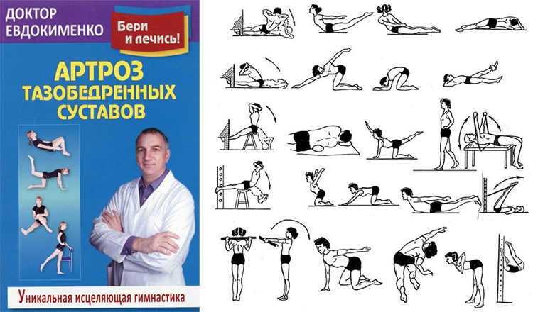 Комплекс упражнений попова (все комплексы): 19 упражнений для позвоночника, плечелопаточный периартрит, борьба с остеохондрозом
